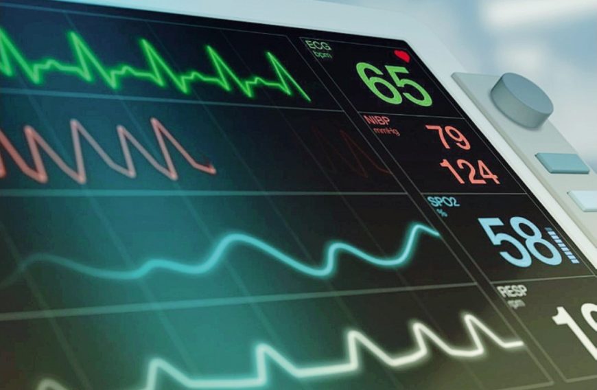 La fibrillazione si può curare anche senza farmaci